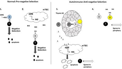 Thymic B Cells as a New Player in the Type 1 Diabetes Response